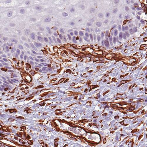 Staining of human skin shows distinct positivity in fibroblasts.