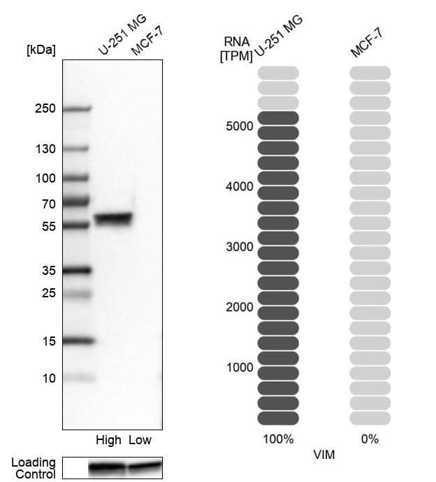 Analysis in human cell lines U-251MG and MCF-7 using Anti-Vimentin antibody. Corresponding Vimentin RNA-seq data are presented for the same cell lines. Loading control: Anti-GAPDH.
