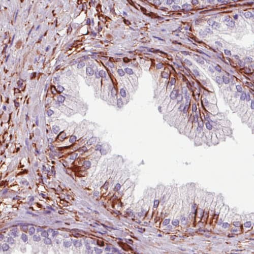 Staining of human prostate shows strong immunoreactivity in the connective tissue.
