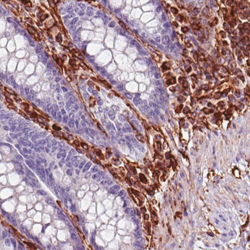 Staining of human rectum shows strong positivity in mesenchymal and lymphoid cells.