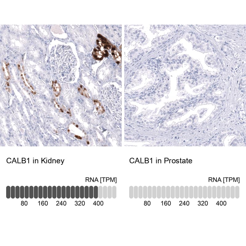 Analysis in human kidney and prostate tissues using NBP3-43925 antibody. Corresponding Calbindin D-28K RNA-seq data are presented for the same tissues.