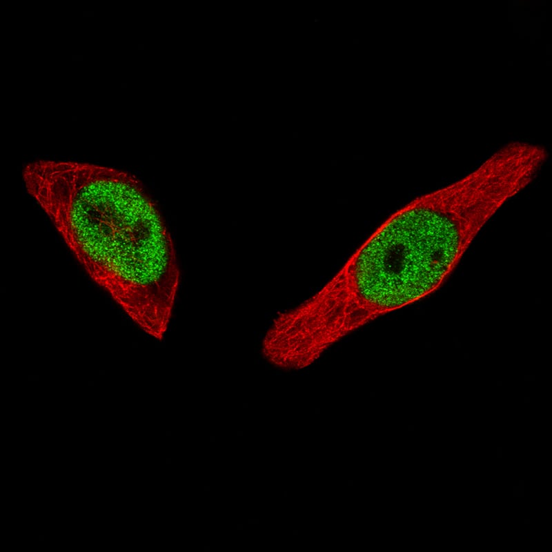 Staining of MCF7 cells, showing specific staining in the nucleoplasm in green. Microtubule- and nuclear probes are visualized in red and blue, respectively (where available).