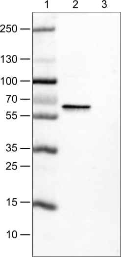 Lane 1: Marker [kDa]Lane 2: Human cell line MCF-7Lane 3: Human cell line SK-BR-3