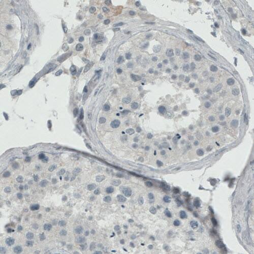 Staining of human testis shows absence of immunoreactivity (negative control).
