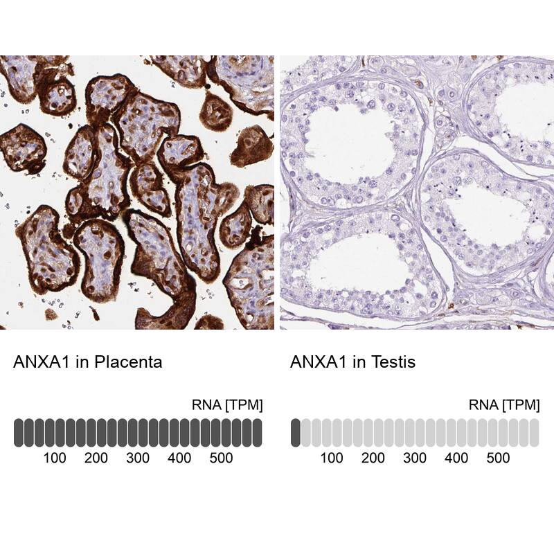 Analysis in human placenta and testis tissues using NBP3-43928 antibody. Corresponding Annexin A1 RNA-seq data are presented for the same tissues.