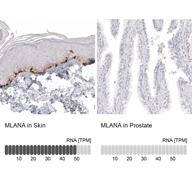 Analysis in human skin and prostate tissues using NBP3-43932 antibody. Corresponding Melan-A/MART-1 RNA-seq data are presented for the same tissues.