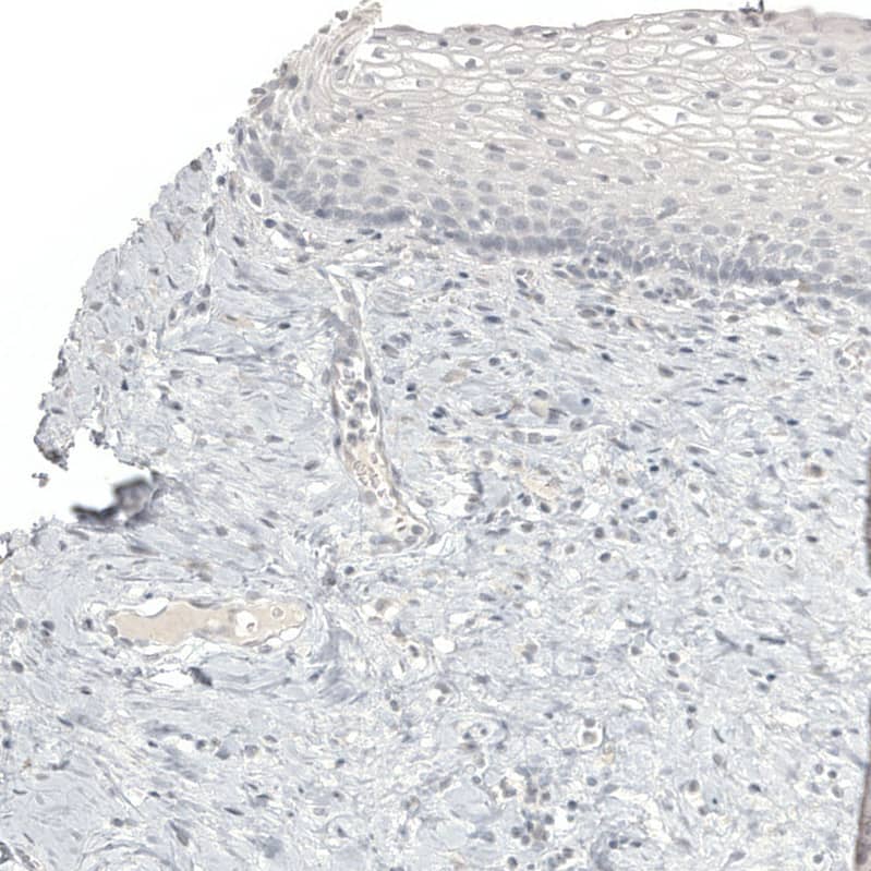 Staining of human cervix shows no positivity in squamous epithelial cells as expected.