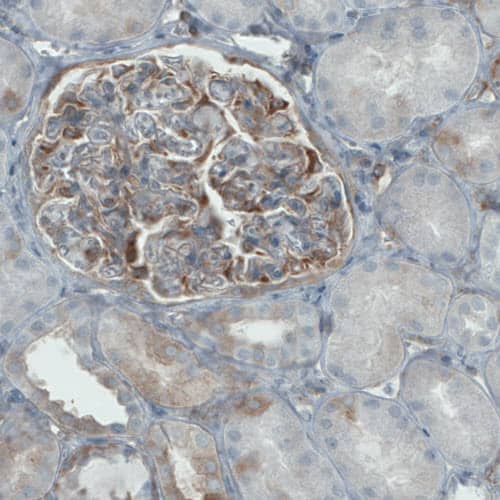 Staining of human kidney shows moderate positivity in renal glomeruli. 