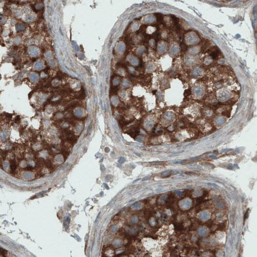 Staining of human testis shows strong cytoplasmic immunoreactivity in seminiferous tubules cells.