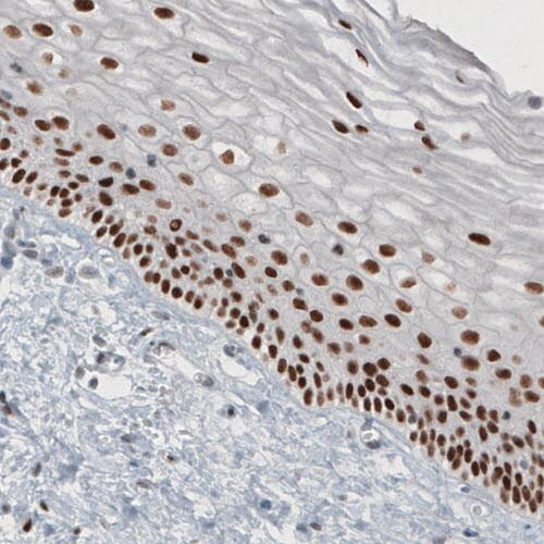 Staining of human cervix shows strong nuclear immunoreactivity in epithelial cells.