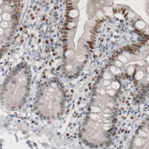 Staining of human small intestine shows moderate nuclear immunoreactivity in glandular epithelium cells.