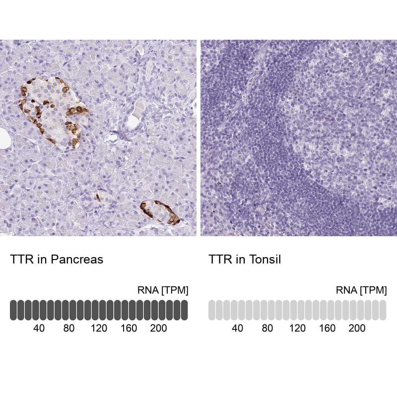 Analysis in human pancreas and tonsil tissues using NBP3-43937 antibody. Corresponding Transthyretin/Prealbumin RNA-seq data are presented for the same tissues.