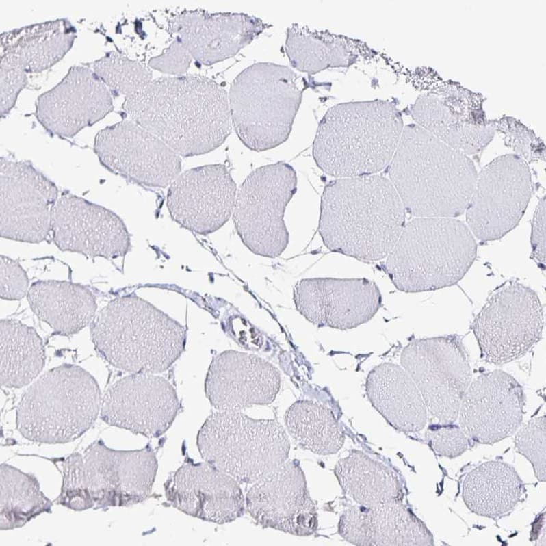Staining of human skeletal muscle shows no positivity in myocytes as expected.