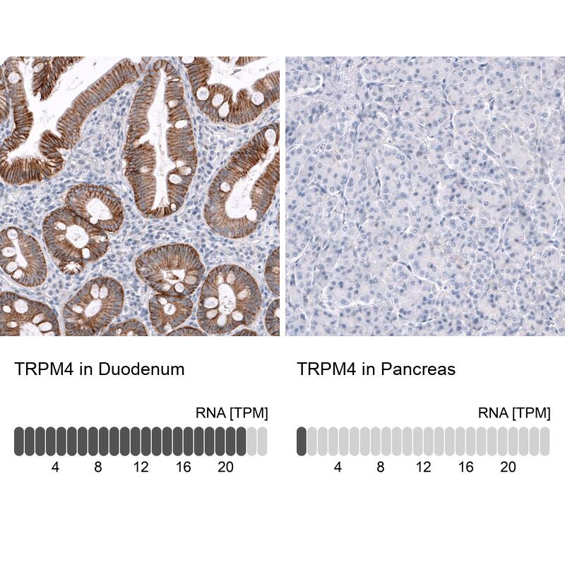 Analysis in human duodenum and pancreas tissues using NBP3-43938 antibody. Corresponding TRPM4 RNA-seq data are presented for the same tissues.