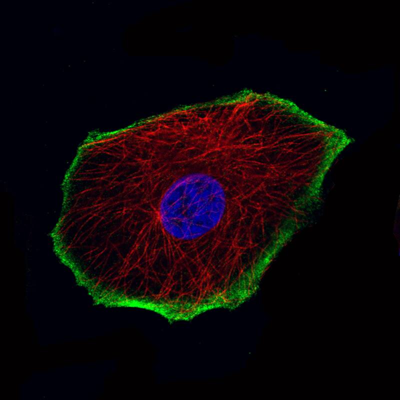 Staining of MCF7 cells using the Anti-TRPM4 monoclonal antibody) .