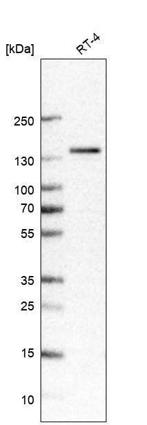 Analysis in human cell line RT-4.