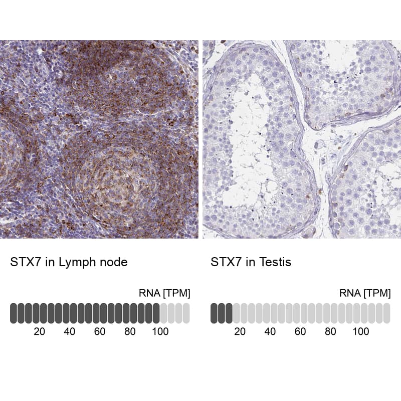Analysis in human lymph node and testis tissues using NBP3-43939 antibody. Corresponding Syntaxin 7 RNA-seq data are presented for the same tissues.