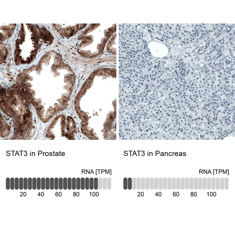 Analysis in human prostate and pancreas tissues using NBP3-43940 antibody. Corresponding STAT3 RNA-seq data are presented for the same tissues.