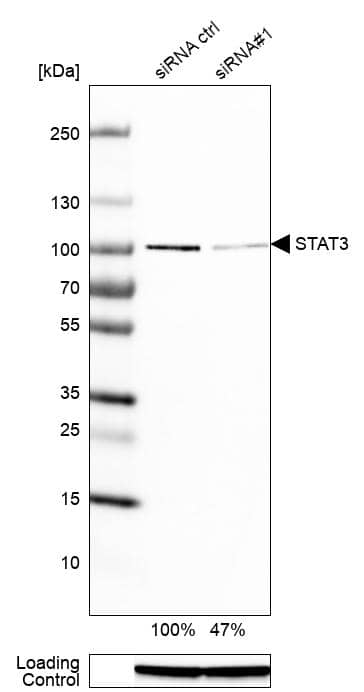 Analysis in RT-4 cells transfected with control siRNA, target specific siRNA probe #1, using Anti-STAT3 antibody. Remaining relative intensity is presented. Loading control: Anti-GAPDH.
