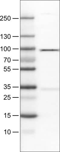 Lane 1: Marker [kDa]Lane 2: Human cell line RT-4