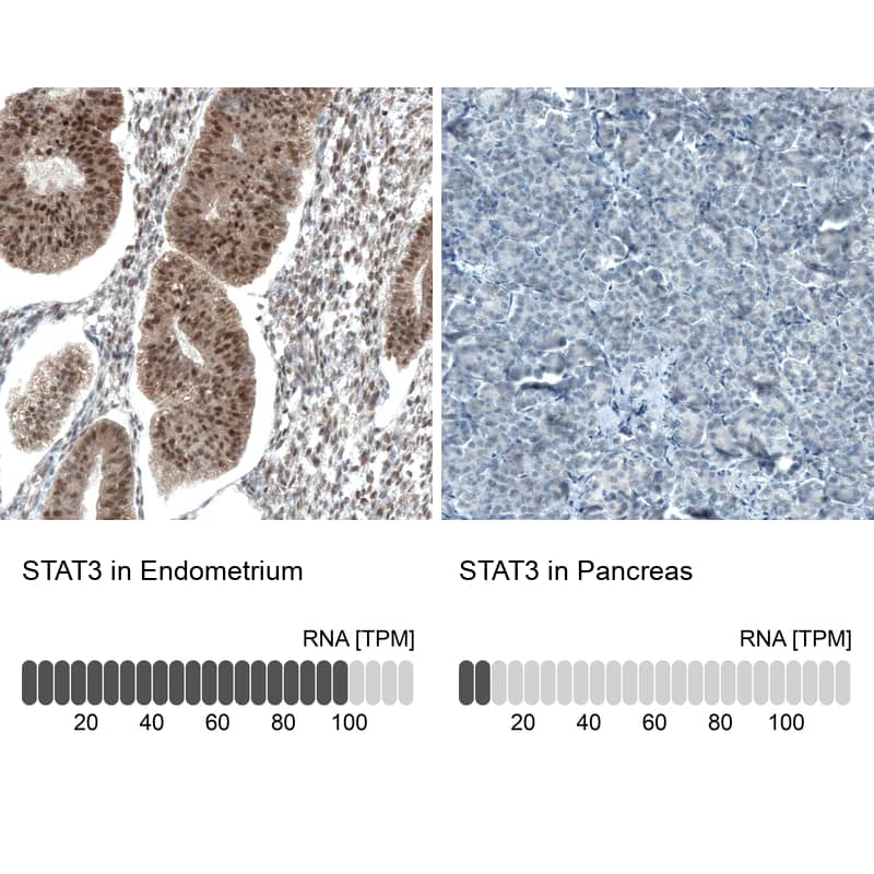 Analysis in human endometrium and pancreas tissues using NBP3-43941 antibody. Corresponding STAT3 RNA-seq data are presented for the same tissues.