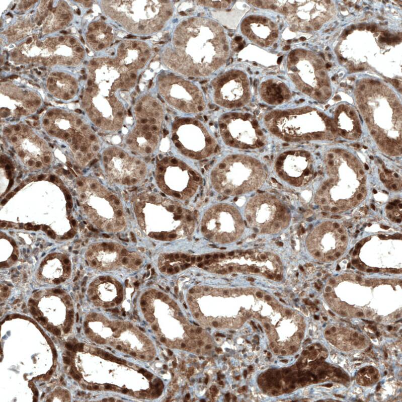 Staining of human kidney shows strong nuclear and moderate cytoplasmic positivity in cells in tubules.