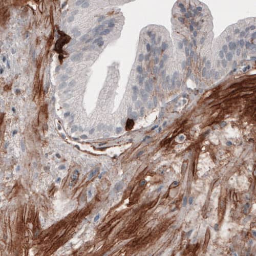 Staining of human prostate shows moderate positivity in smooth muscle.