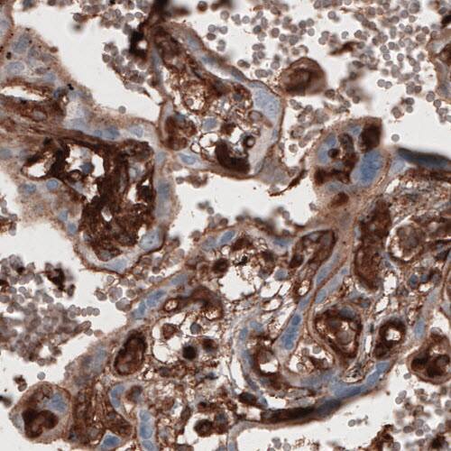 Staining of human placenta shows strong immunoreactivity in chorionic villi.