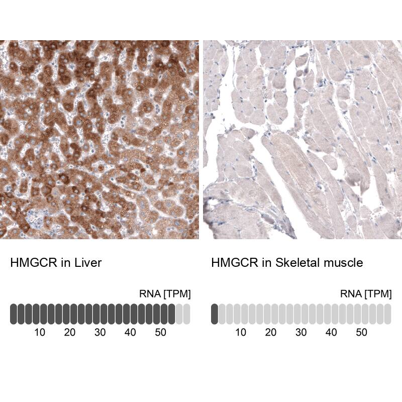 Analysis in human liver and skeletal muscle tissues using NBP3-43943 antibody. Corresponding HMG-CoA Reductase/HMGCR RNA-seq data are presented for the same tissues.