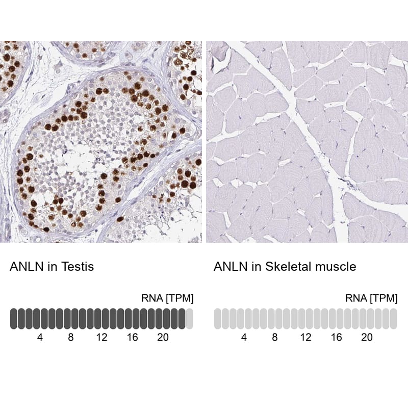 Analysis in human testis and skeletal muscle tissues using NBP3-43944 antibody. Corresponding Anillin RNA-seq data are presented for the same tissues.
