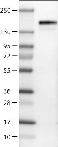Lane 1: Marker [kDa]Lane 2: Human cell line U-251 MG