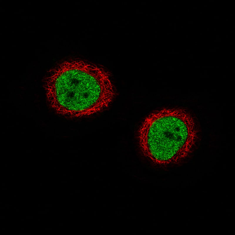 Staining of A-431 cells using the Anti-ATAD2 monoclonal antibody) .