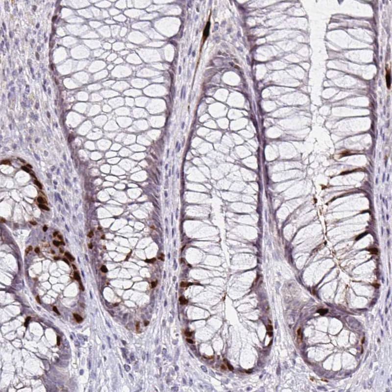 Staining of human rectum shows moderate to strong nuclear positivity in a subset of glandular cells.