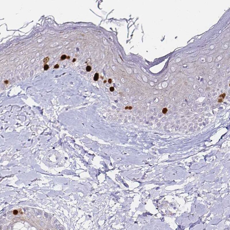 Staining of human skin shows moderate to strong nuclear positivity in a subset of dermal cells.