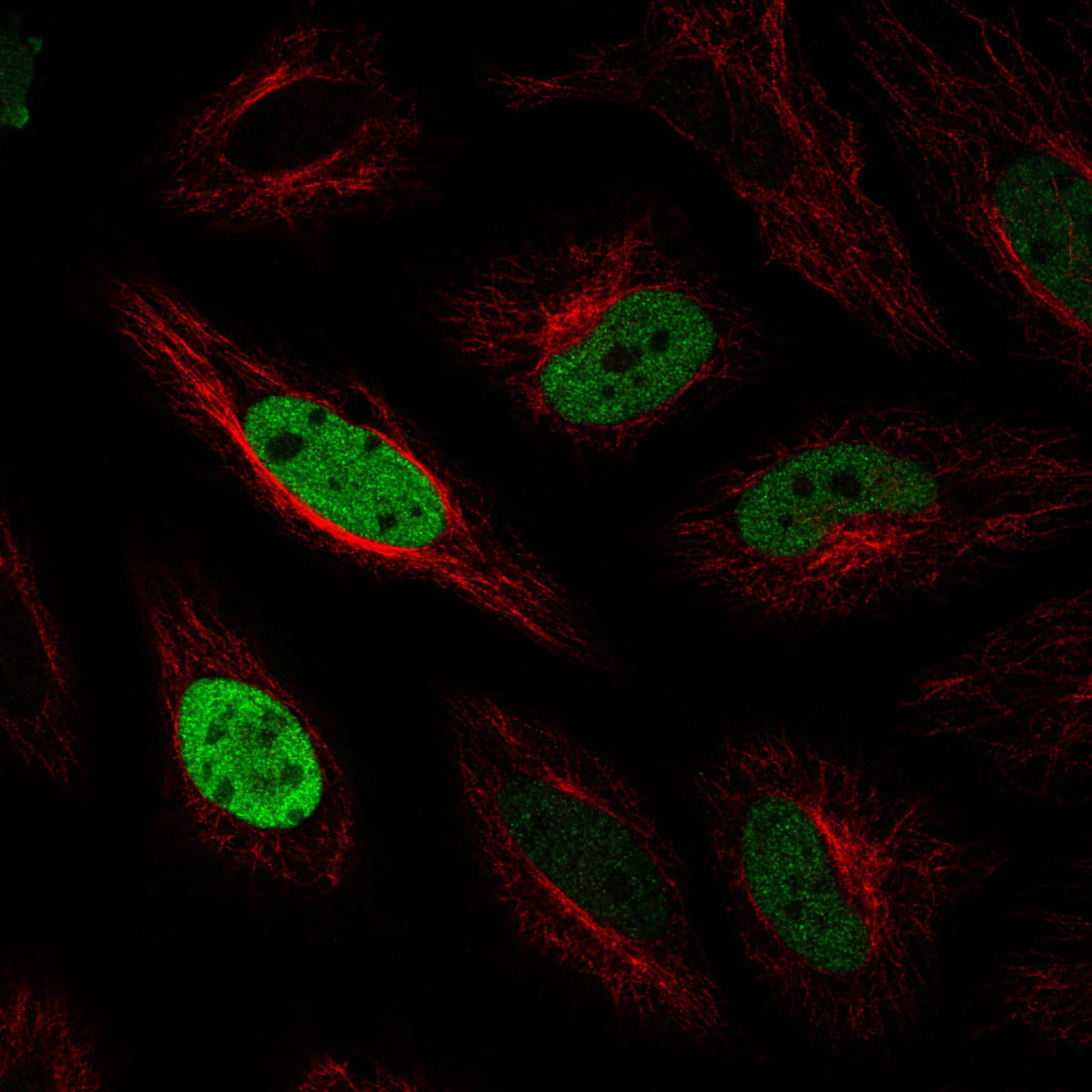 Staining in U2OS cell line with Anti-ANLN monoclonal antibody, showing cell cycle dependent nuclear (without nucleoli) staining in green. Microtubule- and nuclear probes are visualized in red and blue respectively (where available).