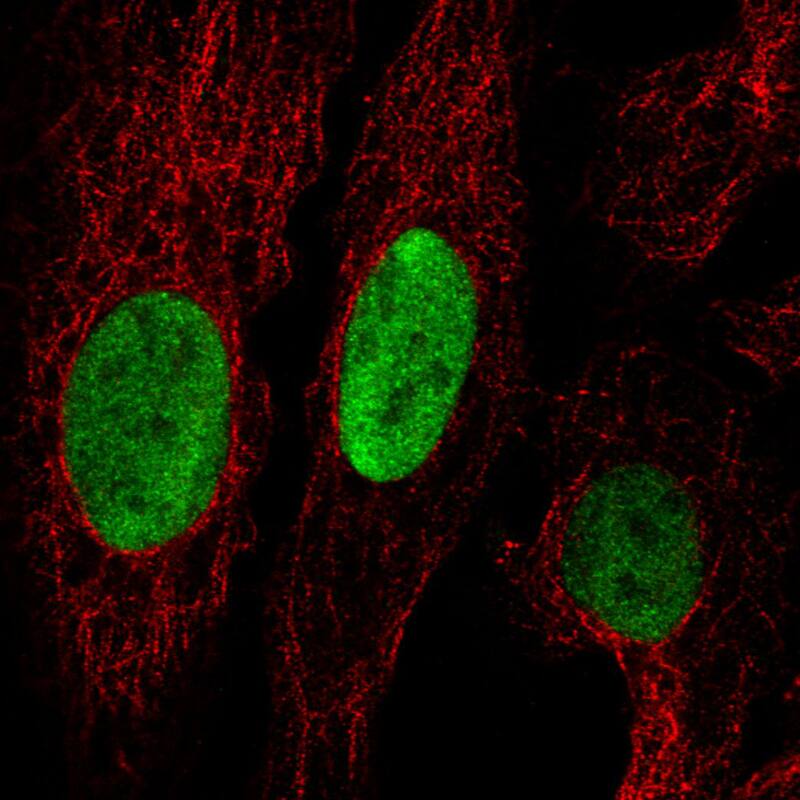 Staining in U2OS cell line with Anti-Anillin monoclonal antibody) staining in green. Microtubule- and nuclear probes are visualized in red and blue respectively (where available).