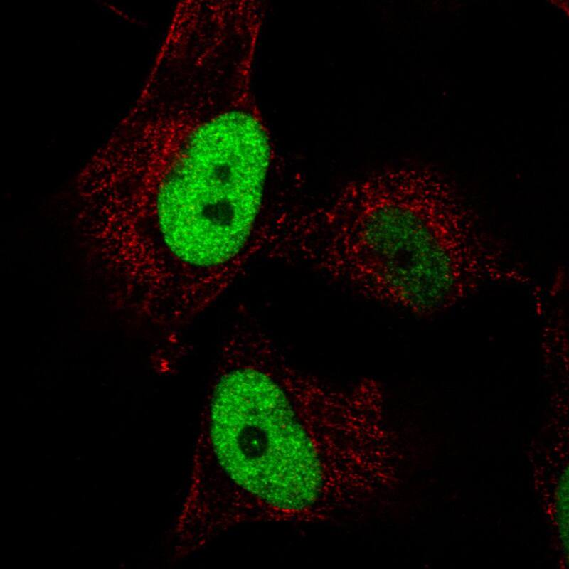 Staining in U251 cell line with Anti-Anillin monoclonal antibody) staining in green. Microtubule- and nuclear probes are visualized in red and blue respectively (where available).