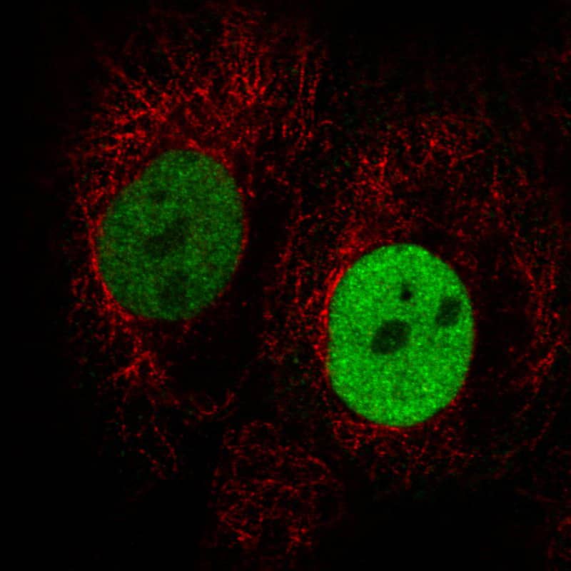 Staining in A431 cell line with Anti-Anillin monoclonal antibody) staining in green. Microtubule- and nuclear probes are visualized in red and blue respectively (where available).