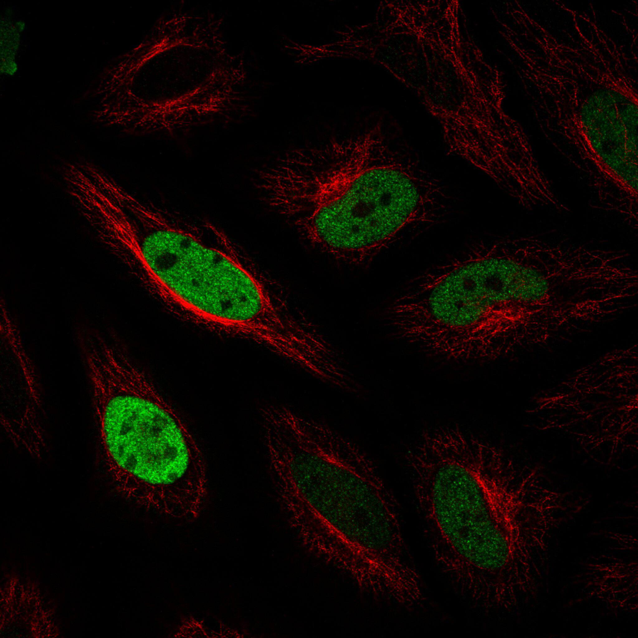 Staining in HeLa cell line with Anti-Anillin monoclonal antibody) staining in green. Microtubule- and nuclear probes are visualized in red and blue respectively (where available).