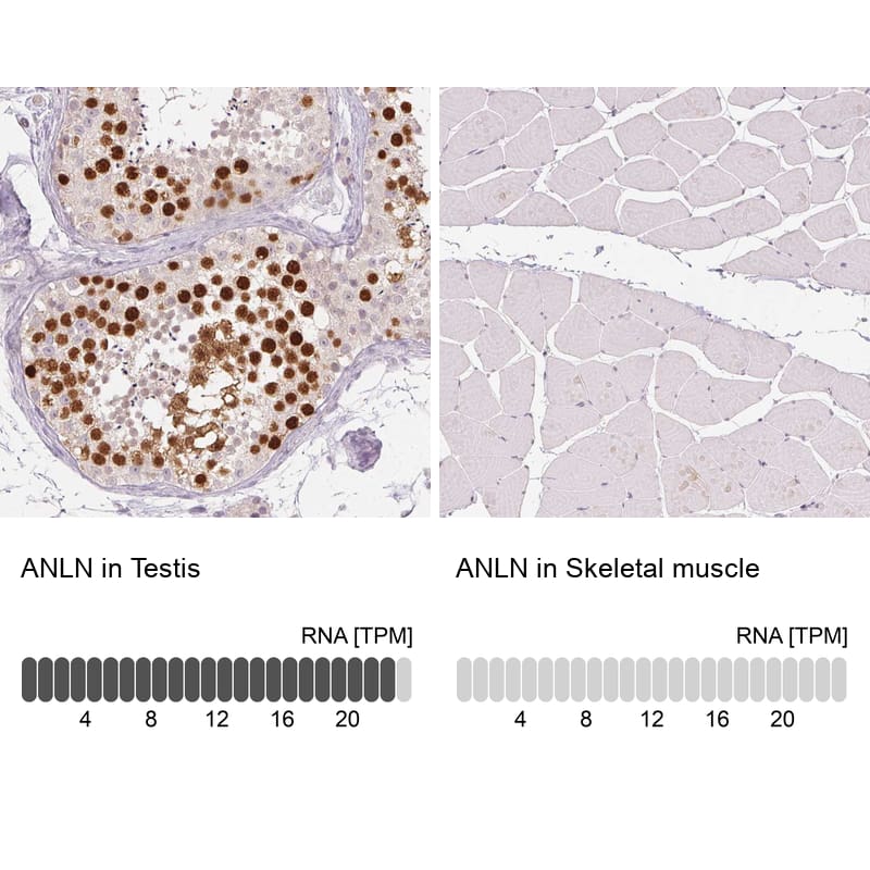 Analysis in human testis and skeletal muscle tissues using NBP3-43945 antibody. Corresponding Anillin RNA-seq data are presented for the same tissues.