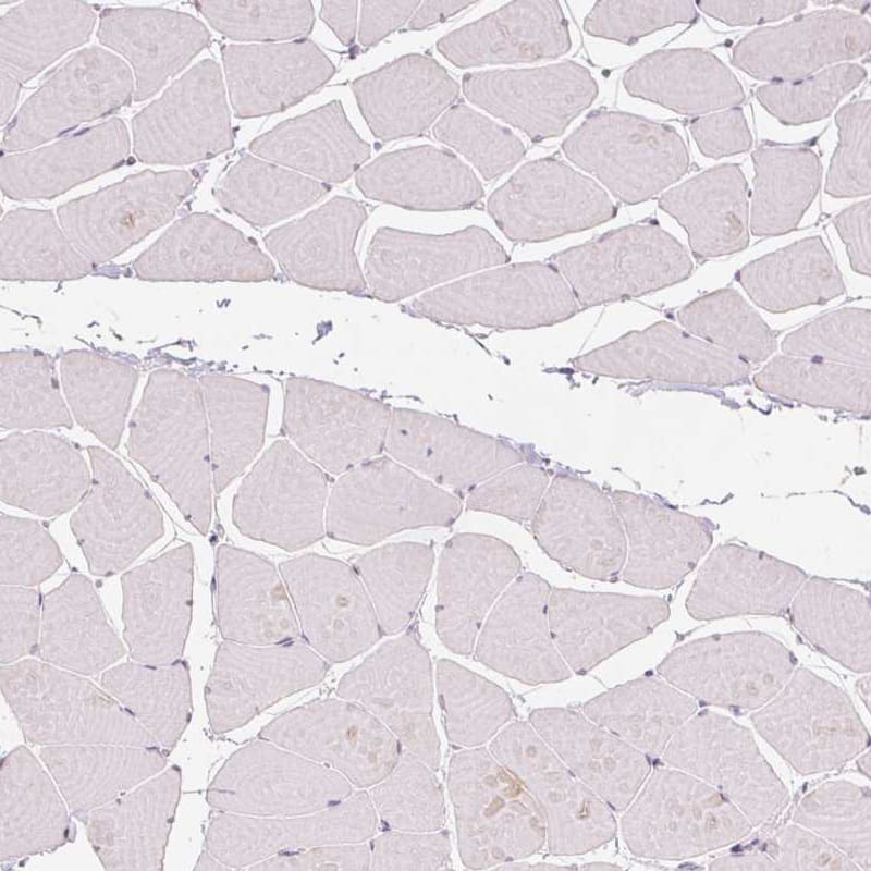 Staining of human skeletal muscle shows no nuclear positivity in striated muscle fibers as expected.