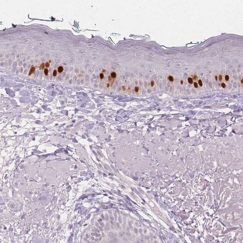 Staining of human skin shows moderate to strong nuclear positivity in a subset of dermal cells.