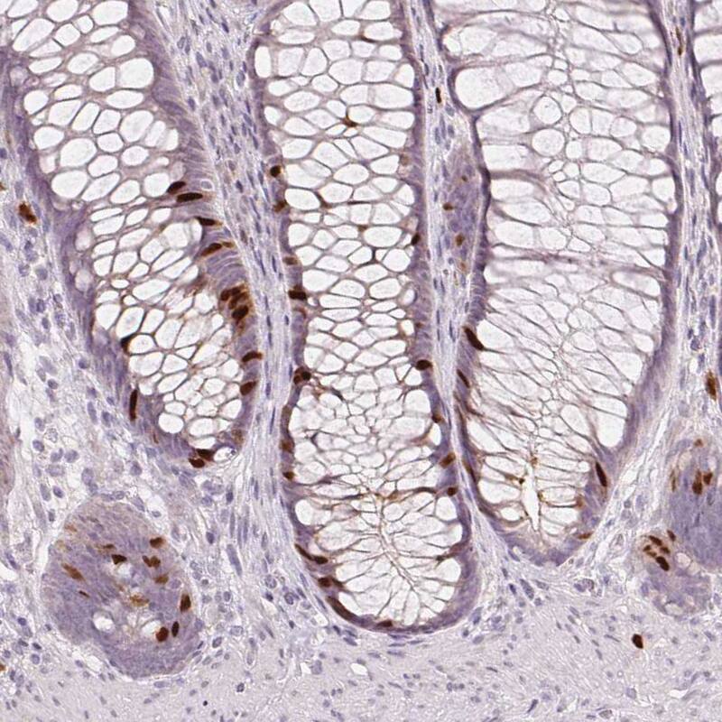 Staining of human rectum shows moderate to strong nuclear positivity in a subset of glandular cells.