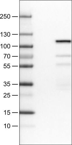 Lane 1: Marker [kDa]Lane 2: Negative control (vector only transfected HEK293T lysate) Lane 3: SATB2 Over-expression Lysate (Co-expressed with a C-terminal myc-DDK tag (~3.1 kDa) in mammalian HEK293T cells) 