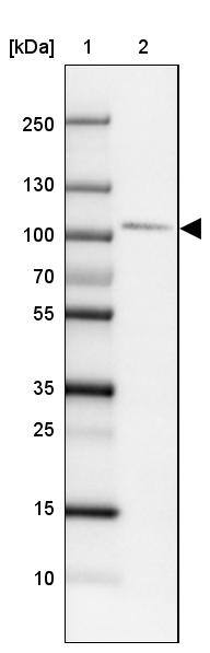 Lane 1: Marker [kDa]Lane 2: Human cell line HEL