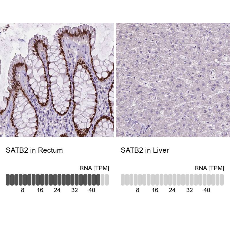 Analysis in human rectum and liver tissues using NBP3-43946 antibody. Corresponding SATB2 RNA-seq data are presented for the same tissues.