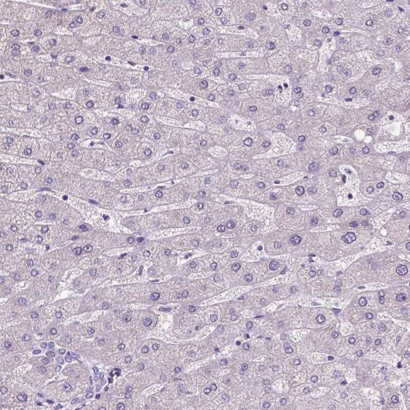 Staining of human liver shows no positivity in hepatocytes as expected.