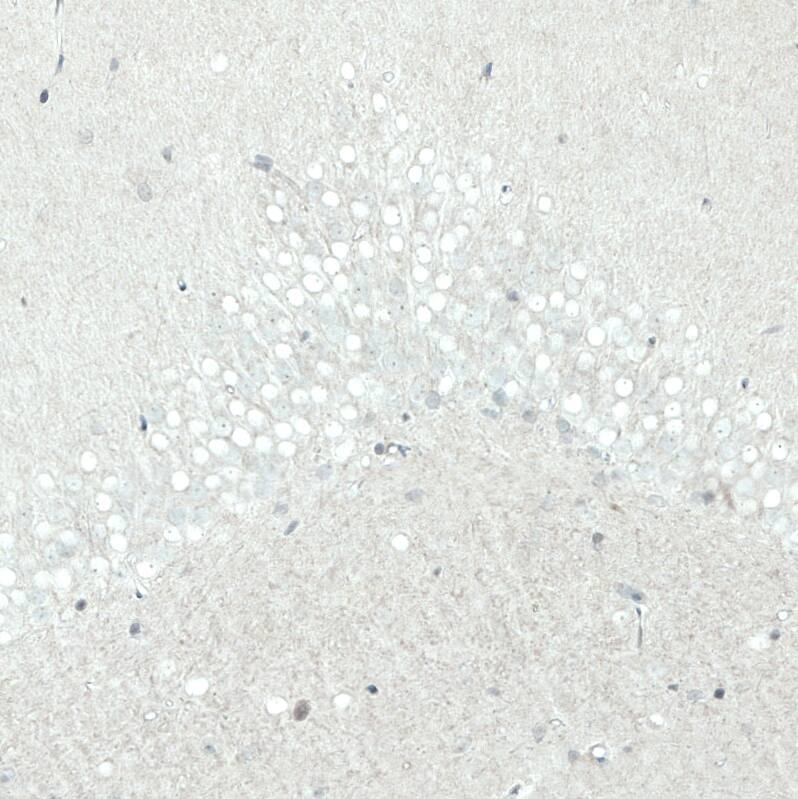Staining of rat hippocampus shows no nuclear positivity in neurons in the dentate gyrus as expected.