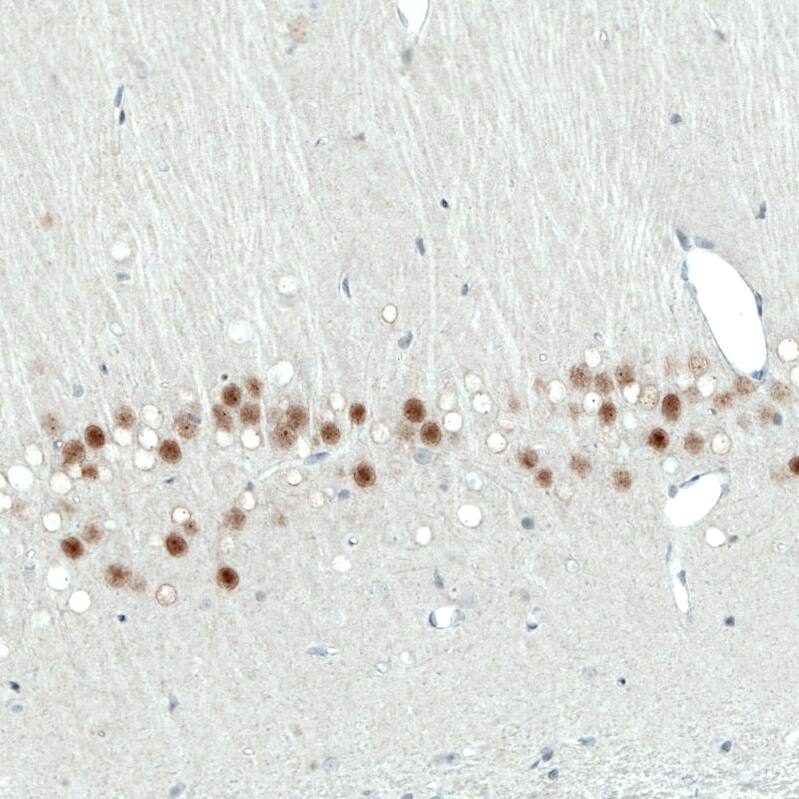 Staining of rat hippocampus shows moderate nuclear positivity in neurons in the CA1 layer.