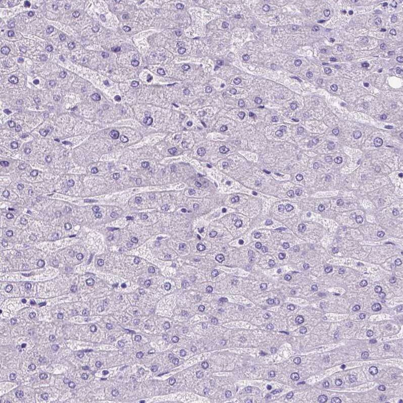 Staining of human liver shows no positivity in hepatocytes as expected.